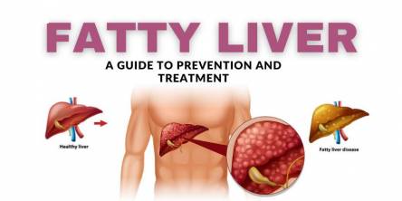 Natural Treatment for Fatty Liver with Ayurvedic Medicine - Fatty Liver Care Pack