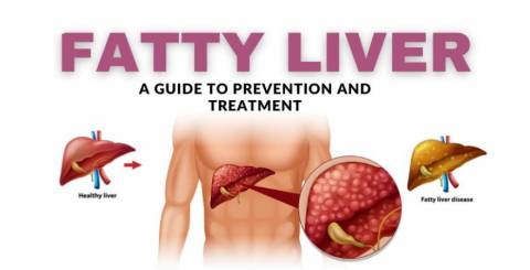 Natural Treatment for Fatty Liver with Ayurvedic Medicine - Fatty Liver Care Pack