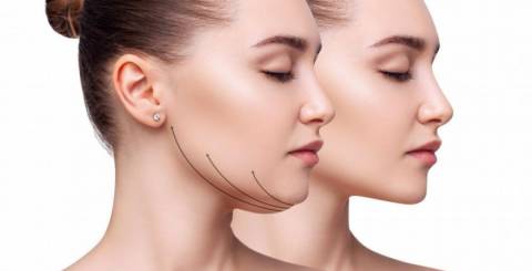 5 Surprising Benefits of Chin Liposuction Beyond Just a Sleeker Profile