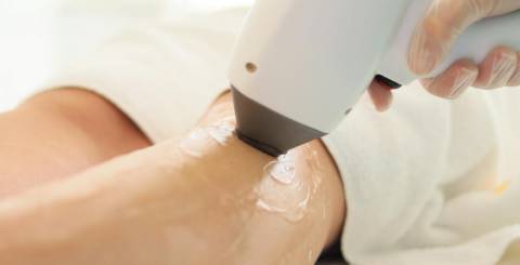 Laser Hair Removal